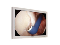 FORESEESON FS-L2402D 24IN Medical Monitor, High-bright LED